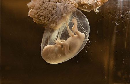 Quin és el moment en què l’embrió es pot considerar un ésser humà de ple dret? / GETTY